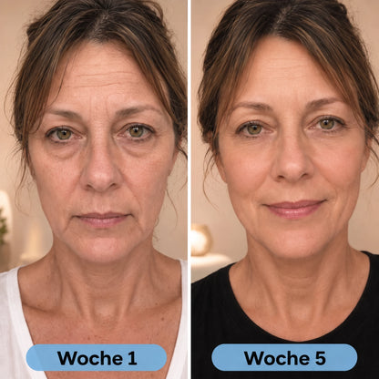 Vorher Nachher Woche 1 Woche 5