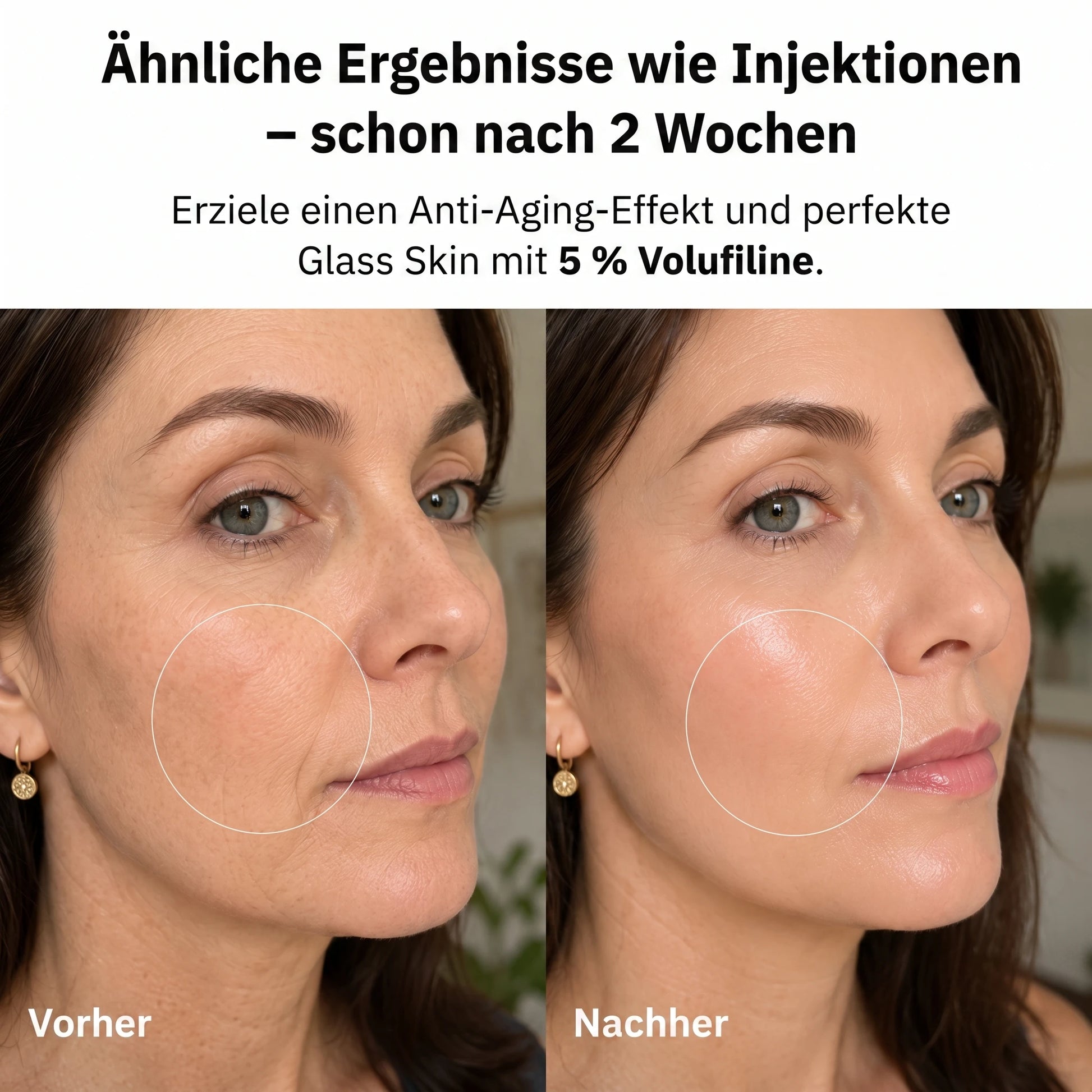 Ergebnisse wie Injektionen nach 2 Wochen