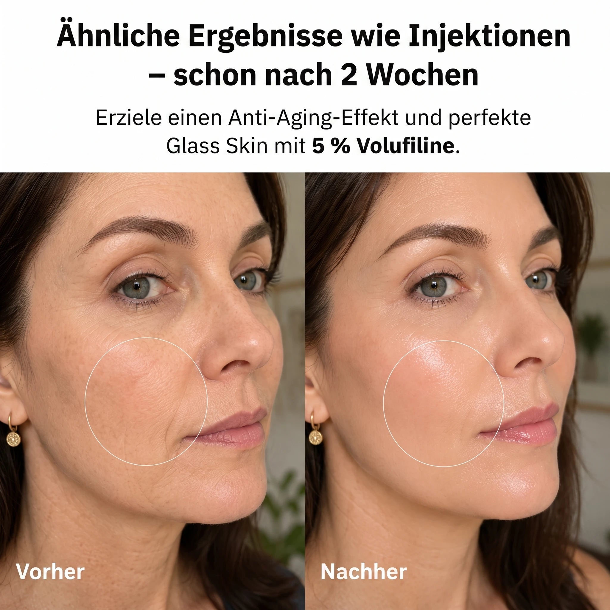 Ergebnisse wie Injektionen nach 2 Wochen