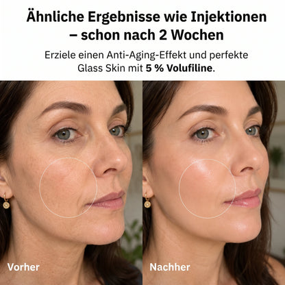 Ergebnisse wie Injektionen nach 2 Wochen